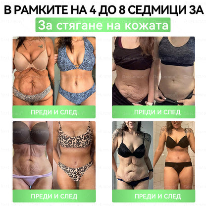 🎄🎄Официален магазин на Apteka Mareshki🎁👩‍⚕️ 𝐆𝐞𝑒𝑙𝑒𝐦𝐨𝐧® Glum𝐚𝐬𝐞tide 8 в 1 – Нано микроиглен пластир за отслабване|Само 1× дневно ✅ Видими промени за 7 дни – при затлъстяване, сърдечно-съдово здраве, диабет и ставни проблеми