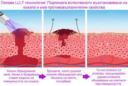 𝐉𝐚𝐬𝐬𝐞𝐞𝐦® Усъвършенствана неинвазивна CO₂ лазерна писалка за възстановяване на кожата 💕 (Нежно премахва брадавици, родилни белези, старчески петна и кожни образувания - без болка, без притеснения!)