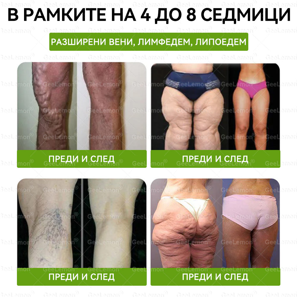 🎄🎄Официален магазин на Apteka Mareshki🎁👩‍⚕️ 𝐆𝐞𝑒𝑙𝑒𝐦𝐨𝐧® Glum𝐚𝐬𝐞tide 8 в 1 – Нано микроиглен пластир за отслабване|Само 1× дневно ✅ Видими промени за 7 дни – при затлъстяване, сърдечно-съдово здраве, диабет и ставни проблеми