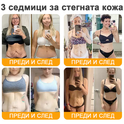 VLSVLS® Крем с пчелна отрова за регенерация на кожата (👨‍⚕️ подходящ за всички възрастови групи, препоръчан от AAD) 🎁