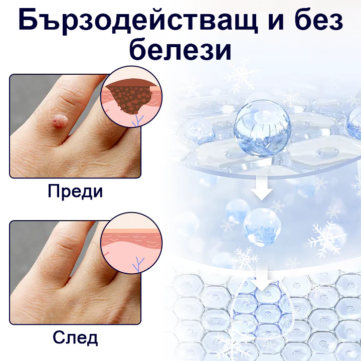 Timilk® 🌟WartErase Крио Спрей за Замразяване на Брадавиците