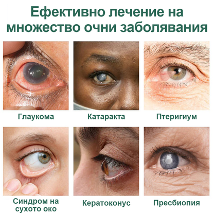 👩‍⚕️Ourlyard® Nano Eye Drops Serum ✅Одобрен от FDA (Подходящ за пресбиопия, синдром на сухото око, глаукома и катаракта) 👀