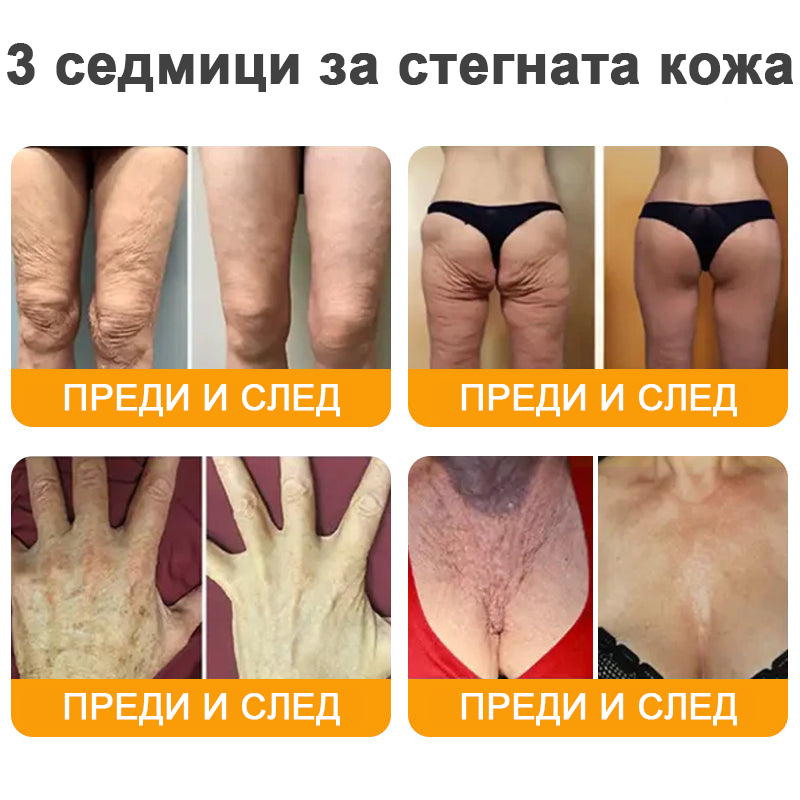 VLSVLS® Крем с пчелна отрова за регенерация на кожата (👨‍⚕️ подходящ за всички възрастови групи, препоръчан от AAD) 🎁