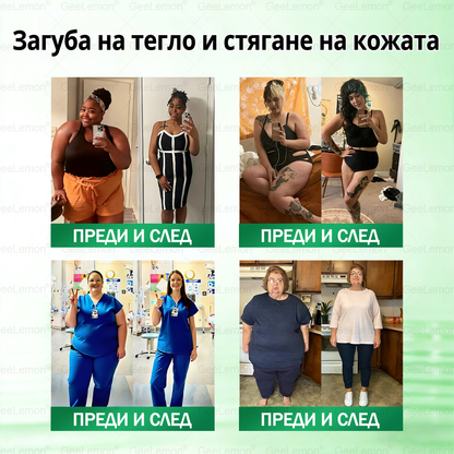 🎄🎄Официален магазин на Apteka Mareshki🎁👩‍⚕️ 𝐆𝐞𝑒𝑙𝑒𝐦𝐨𝐧® Glum𝐚𝐬𝐞tide 8 в 1 – Нано микроиглен пластир за отслабване|Само 1× дневно ✅ Видими промени за 7 дни – при затлъстяване, сърдечно-съдово здраве, диабет и ставни проблеми