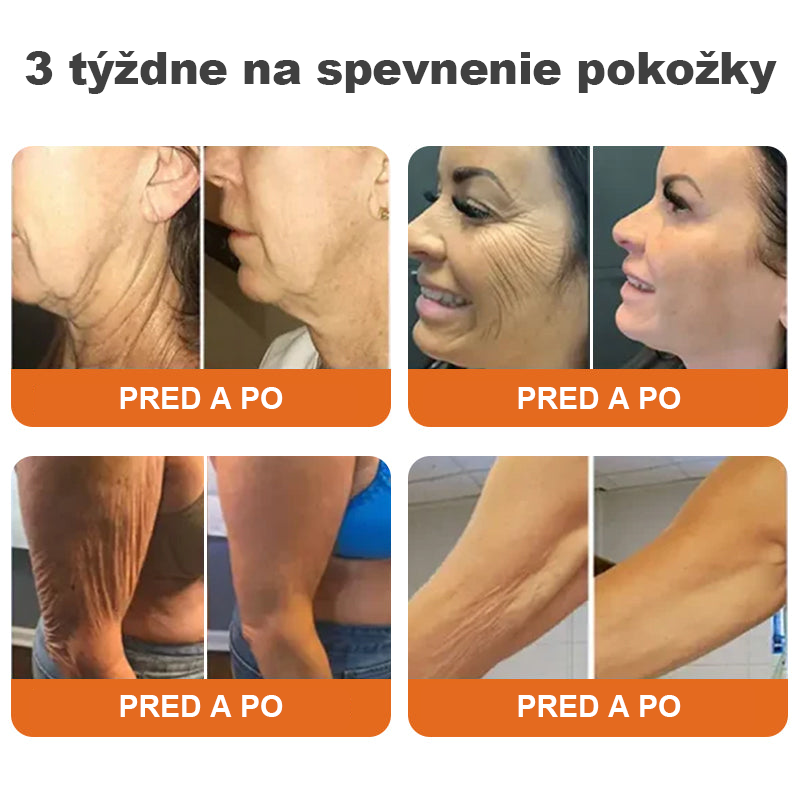 🌴🎁Vyrobené a dodané z Austrálie - Flysmus® AH-8 krém na sťahovanie a lifting krku - POSLEDNÝ DEŇ ZĽAVA 70%