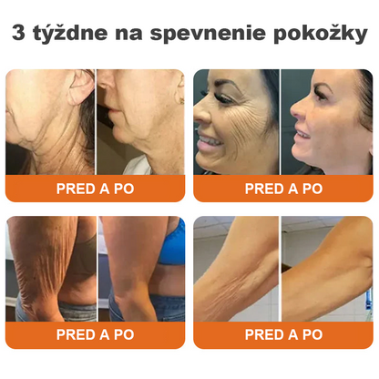 🌴🎁Vyrobené a dodané z Austrálie - Flysmus® AH-8 krém na sťahovanie a lifting krku - POSLEDNÝ DEŇ ZĽAVA 70%